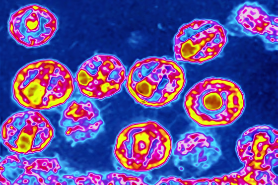 Image: Colorized electron microscope image of the HIV virus.