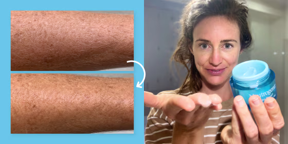 woman showcasing neutrogena water gel