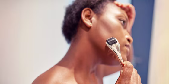 Close-up image of a woman microneedling her face with a gold and black roller