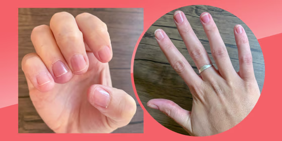 Before and after illustration of Emma Stessmans hand after using the ella+mila Nail Care