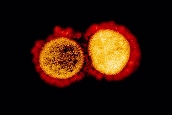 A transmission electron micrograph of SARS-CoV-2 virus particles.