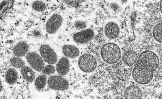A monkeypox virion, obtained from a clinical sample associated with the 2003 prairie dog outbreak.