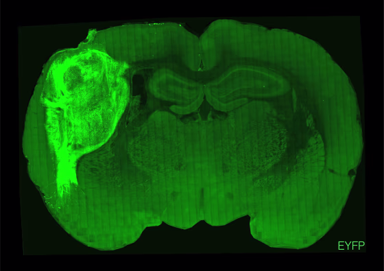 A transplanted human organoid labeled with a fluorescent protein in a section of the rat brain.