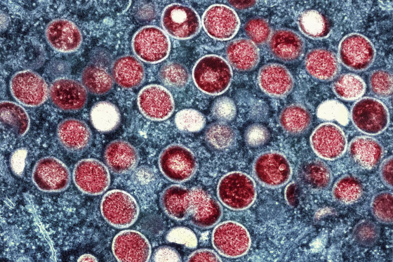 Image: This colorized electron microscope image shows mpox particles, red, found within an infected cell, blue, cultured in a laboratory in Fort Detrick, Md.