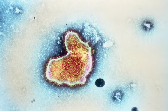 Transmission electron micrograph of a respiratory syncytial virus (RSV).