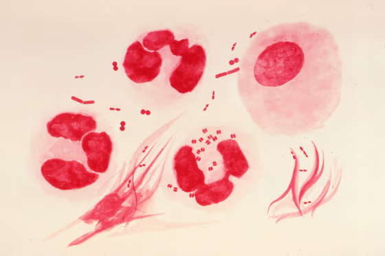 Neisseria gonorrhoeae