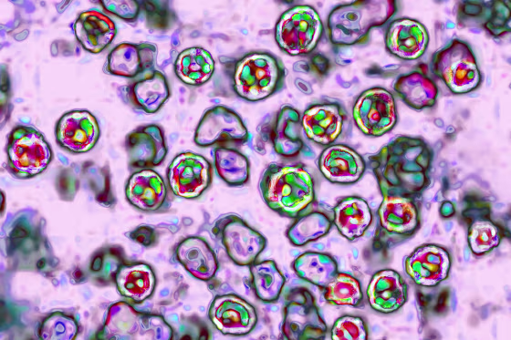 Measles Virus
