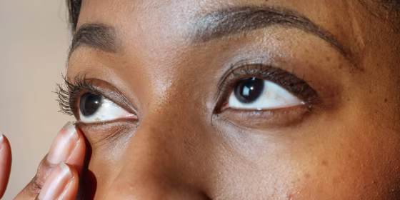 Fragrance-free, oil-based cleansers can help remove debris from the eyelid and keep the eyes comfortable.