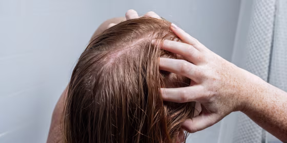 Experts recommend washing with sulfate-free shampoos, avoiding heat styling and continuing to take prenatal vitamins.
