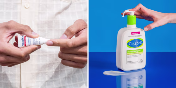 Accutane users should consider moisture-rich skin care products.