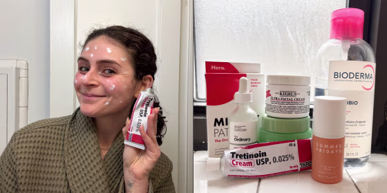 Tretinoin is considered the gold standard acne treatment, but it’s a very strong medication, so pairing it with the right skin care products is essential.