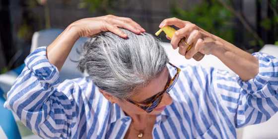 Experts say regardless of your hair coverage, scalp sunscreen can help protect the highly exposed area from sun damage.