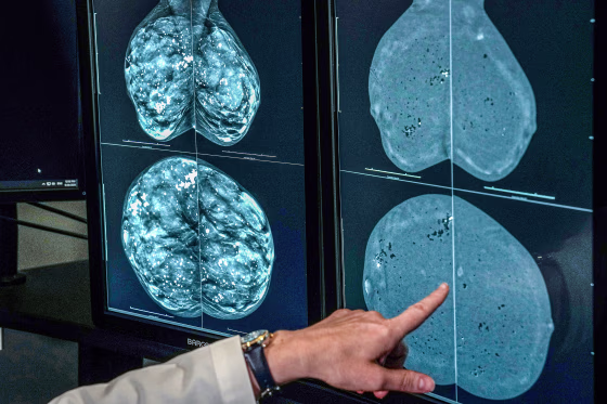 A doctor looks at mammogram imagery.