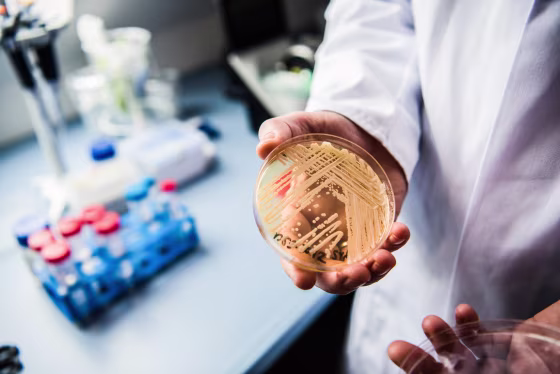 A hand holding a petri dish with yeast inside, thick beige lines are scattered on top of a clear dish