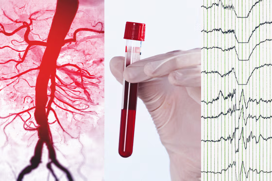 Photo illustration showing a 3D rendering of an aorta, a vial of blood, and an EEG reading