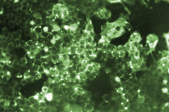 rubeola (measles) virus antigen.