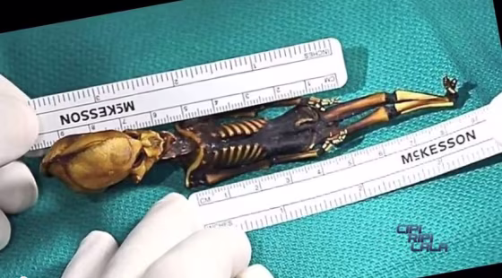 A 6-inch-long (15-centimeter-long) skeleton was found in Chile's Atacama Desert. The skeleton showed several anomalies, including its alienlike skull, teensy body and the fact that it had just 10 ribs rather than the 12 that healthy humans normally have.