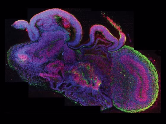 Image: Organoid