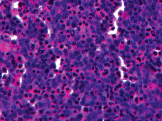 Researchers at Organovo now use bioprinting to keep human liver tissue samples like the one pictured above in a cross-section functioning for 40 days.