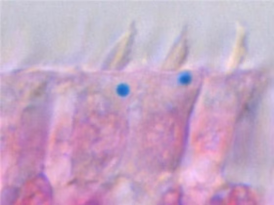 Cells from the inner ear of pigeons stained with a chemical that turns iron bright blue.