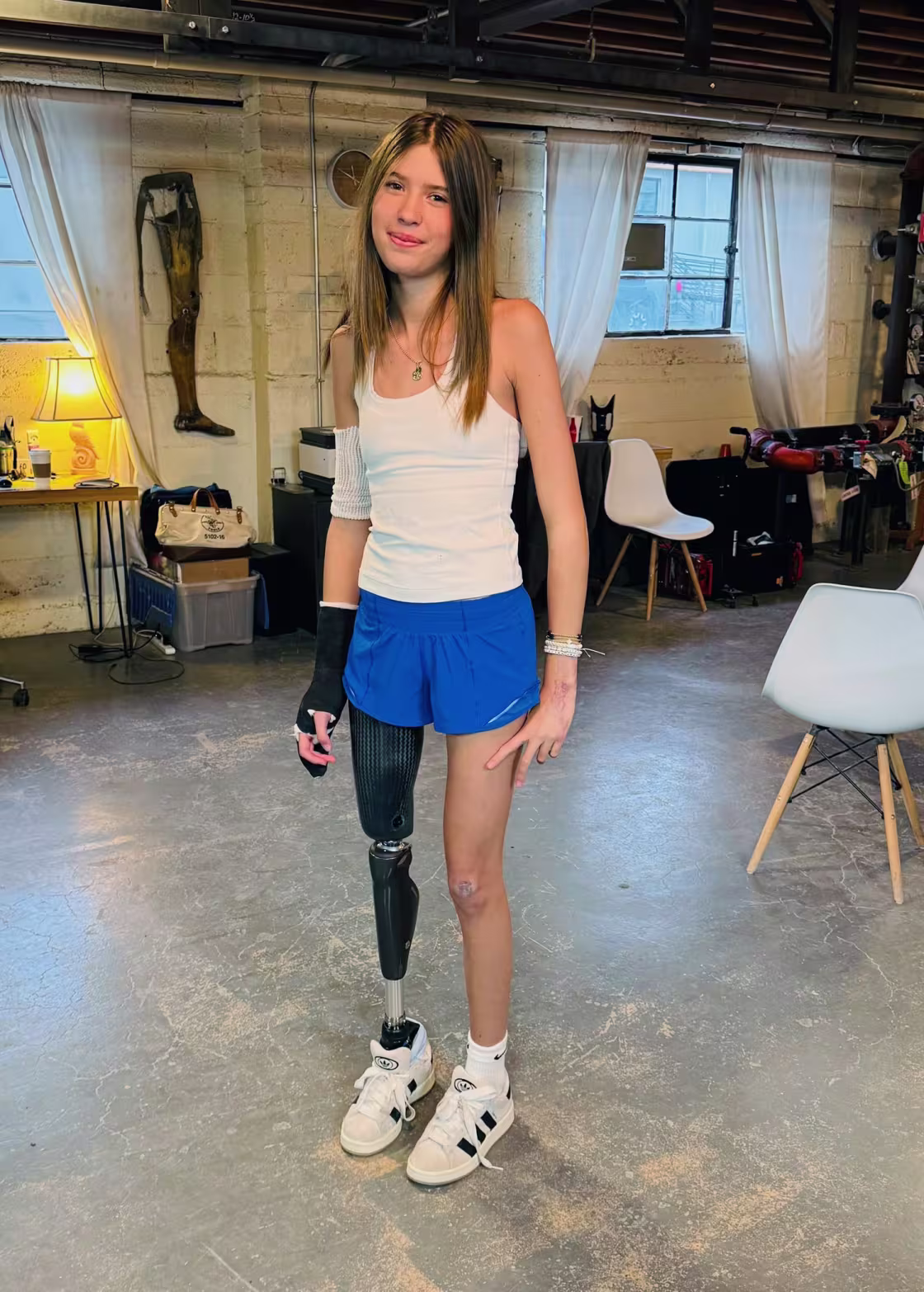 “I think this situation just really goes to show that there is light at the end of the tunnel. Because I do have my prosthetic now. I’d say I’m thriving, right?” Annabelle Carlson said