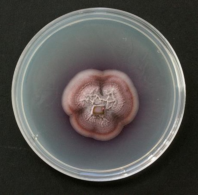 Image: Fungus in petri dish