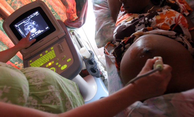 A sonar is performed on a pregnant patient at the AIDS Care Training and Support Initiative (ACTS) at White River Junction, South Africa, Monday Dec. 15, 2008. The center, partly funded by USAID and the President's Emergency Plan for AIDS Relief (PEPFAR) supports the development of a community-based palliative care unit which provides care, education and training for staff and community caregivers, volunteer counseling and testing facilities.  (AP Photo/Denis Farrell)