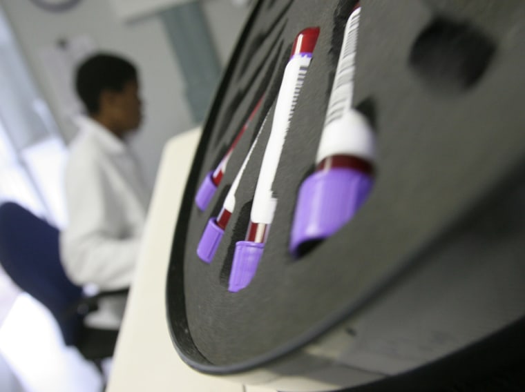 Blood is tested in a TOGA container converted into a laboratory at the AIDS Care Training and Support Initiative (ACTS) at White River Junction, South Africa, Monday Dec. 15, 2008. The center, partly funded by the President's Emergency Plan for AIDS Relief (PEPFAR) supports the development of a community-based palliative care unit which provides care, education and training for staff and community caregivers, volunteer counseling and testing facilities.  (AP Photo/Denis Farrell)