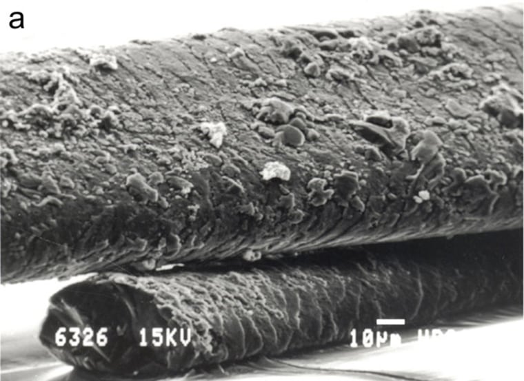 Image: micrographs of human hairs