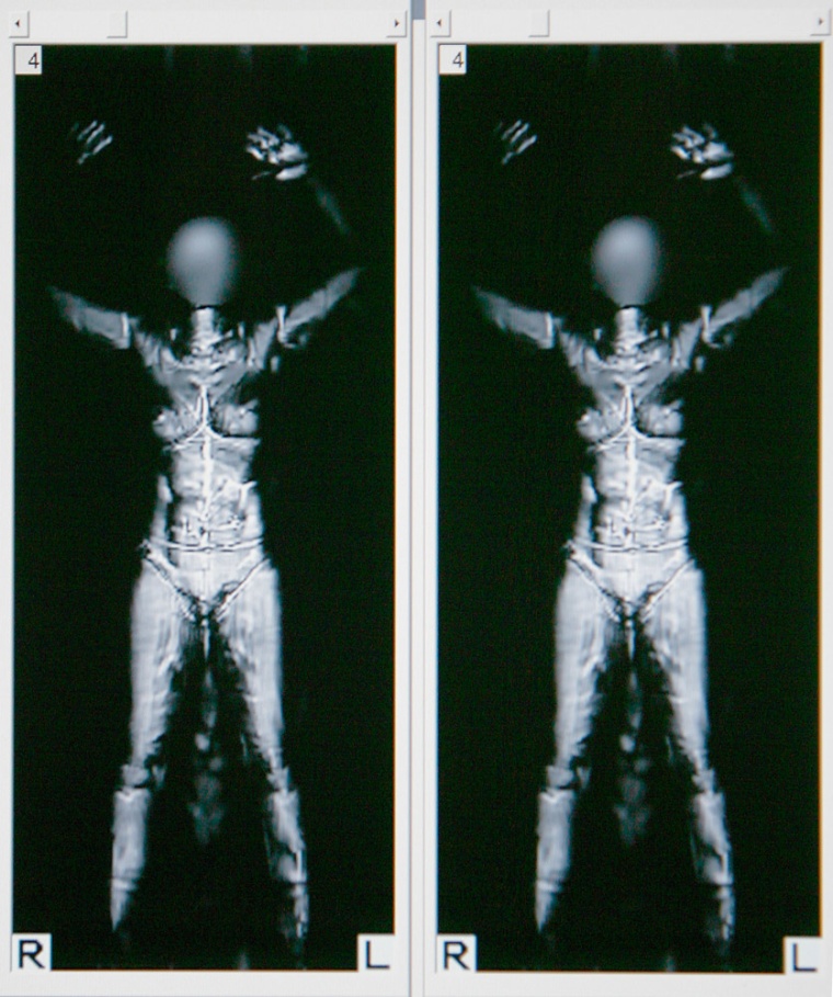 Image: full body scanner image
