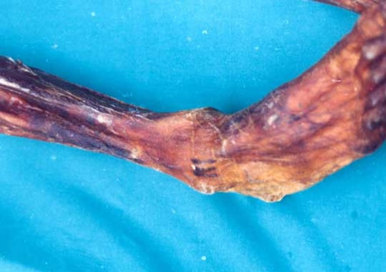 A tattoo on the leg of the 5300-year-old Tyrolean iceman mummy, Oetzi, is shown. New research shows the tattoos were made from fireplace soot that contained glittering, colorful precious stone crystals. 