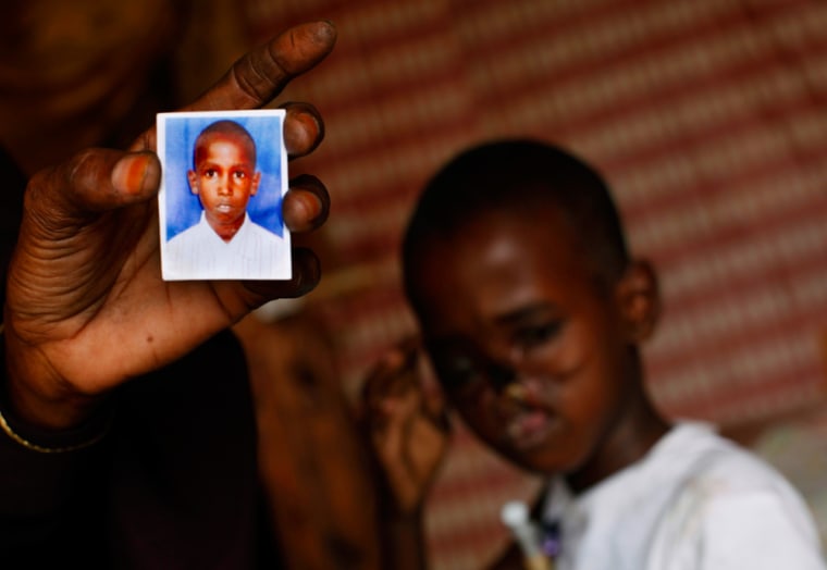 Image: Child injured in Somalia