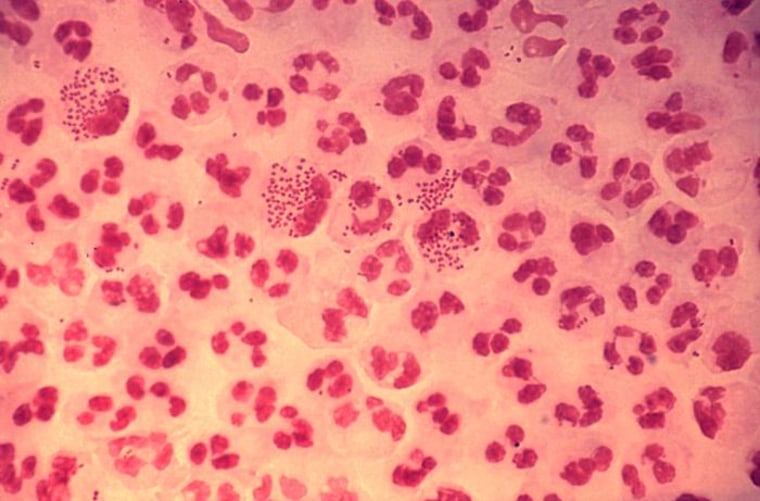 Image: gonorrhea bacteria