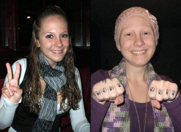 Image: Ashley Kirilow has admitted she shaved her head, plucked her eyelashes and starved herself to appear as a chemotherapy patient at benefit concerts held for her
