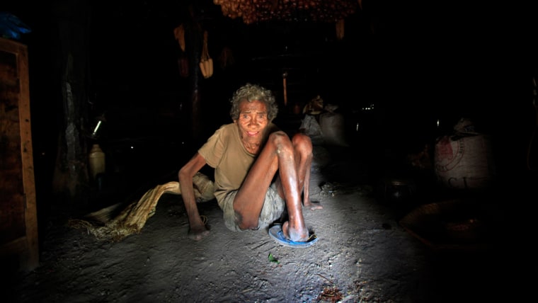 Image: Former leprosy patient Adelino Quelo sits inside his hut in Malelat, West Oe-cusse.