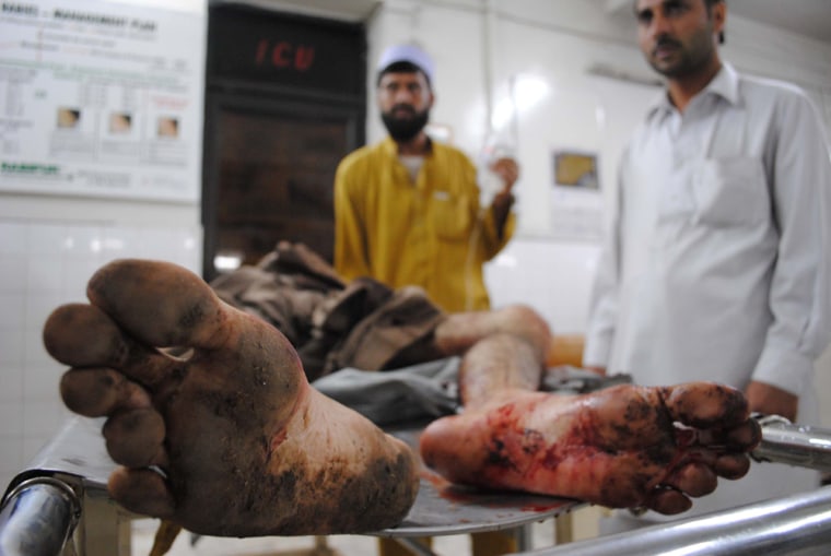Image: Injured person in Peshawar, Pakistan
