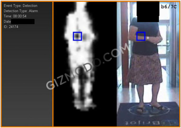 Image: Body scan record of a woman