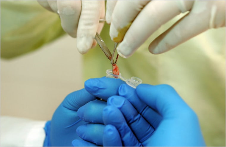 A tumor from a patient is placed in a vial.