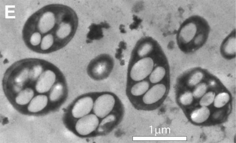 Transmission electron micrograph shows a strain of the bacterium called GFAJ-1, which researchers claimed can incorporate arsenic into its DNA and other vital molecules, in place of the usual phosphorus.