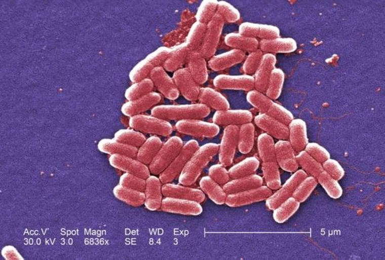Image: Electronic micrograph shows Escherichia coli bacteria