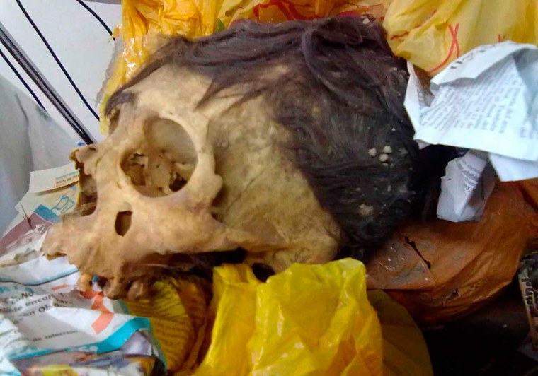 Image: Handout picture of a skull detected by customs officials from Argentina's Tax Agency in Buenos Aires