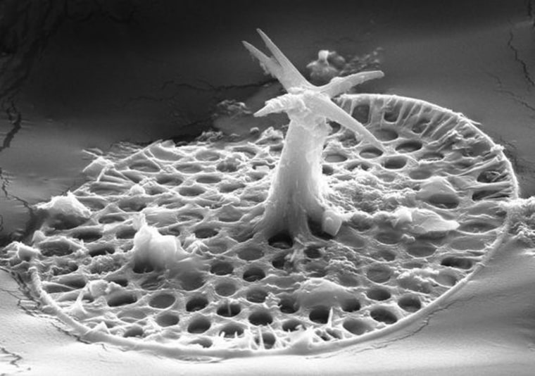 Scanning electron microscopy reveals that the microfossil Characodictyon is about 20 microns long, or one-fifth the width of a human hair, and covered in spiny plates.