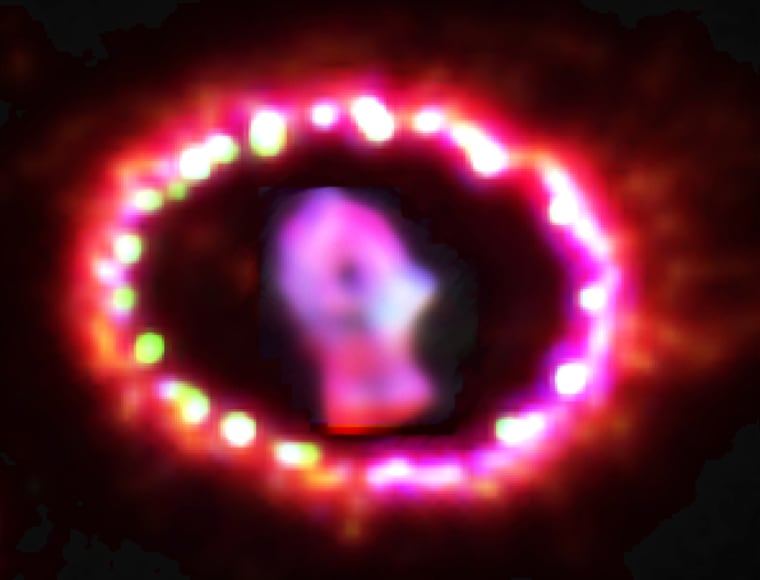Image: SN 1987A
