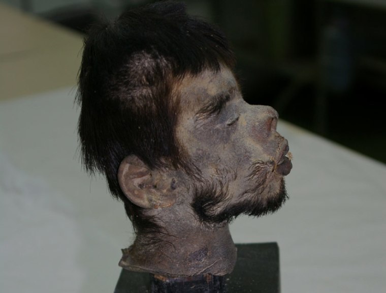 DNA analysis of this shrunken head displayed at the Eretz Israel Museum in Tel Aviv proved its authenticity. The head remains in an incredible state of preservation, with the deceased man's hair, facial features and other physical characteristics intact.