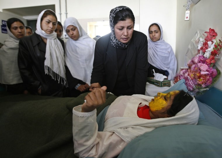 Image: Shamsia, 17, victim of an acid attack by the Taliban, is visited by her friends at a hospital in Kabul