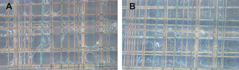 The first (A) and fourth (B) day after seeding the mesh frame, researchers found skin cells spread from the corners into the meshes.