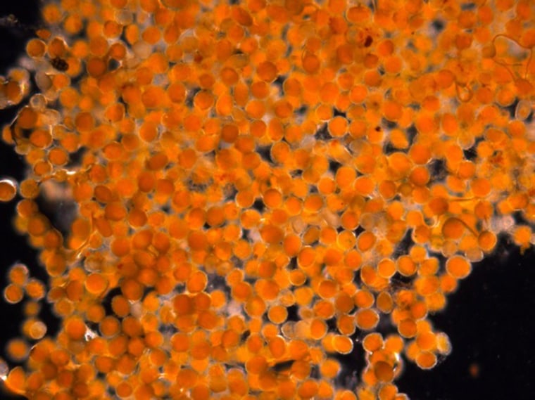 Image: A magnified close up of a sample of orange gunk tested by NOAA scientists in Juneau, Alaska