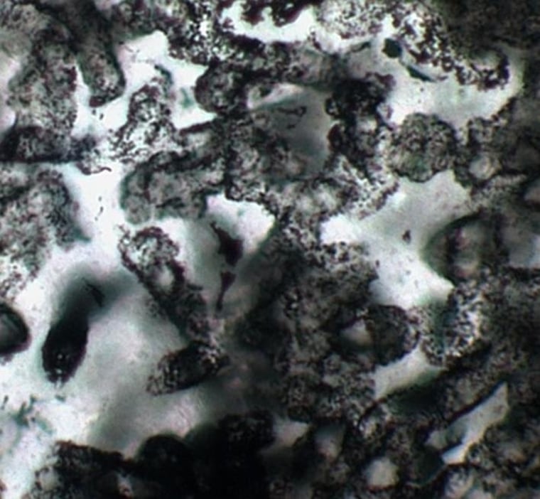 Image: Tubular microfossils