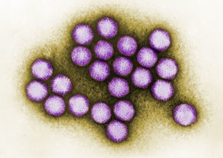 An image of adenovirus, a type of virus known to cause respiratory infections, diarrhea and other problems, in humans, was among several viruses, many of them previously unknown, to turn up in samples of raw sewage.