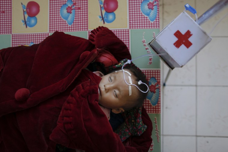 Image: A North Korean child suffering from malnutrition rests in a bed in a hospital in Haeju